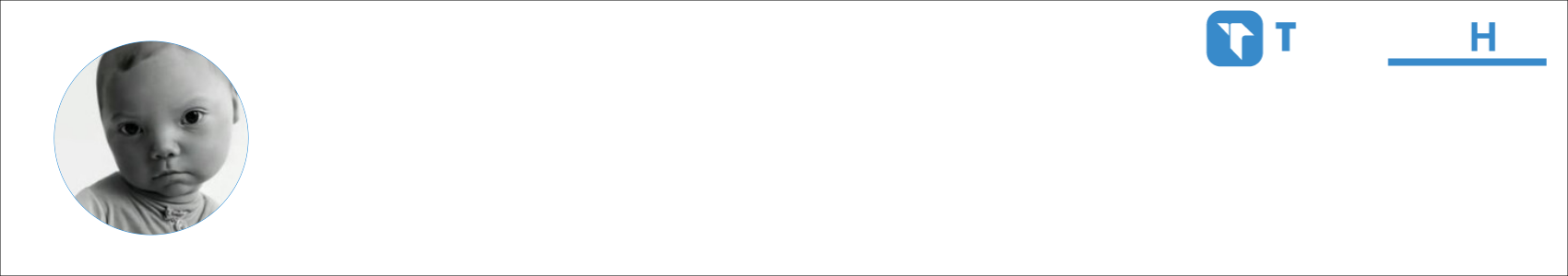 𝘼𝙆𝙐𝙈𝘼 鬼 Activity Banner